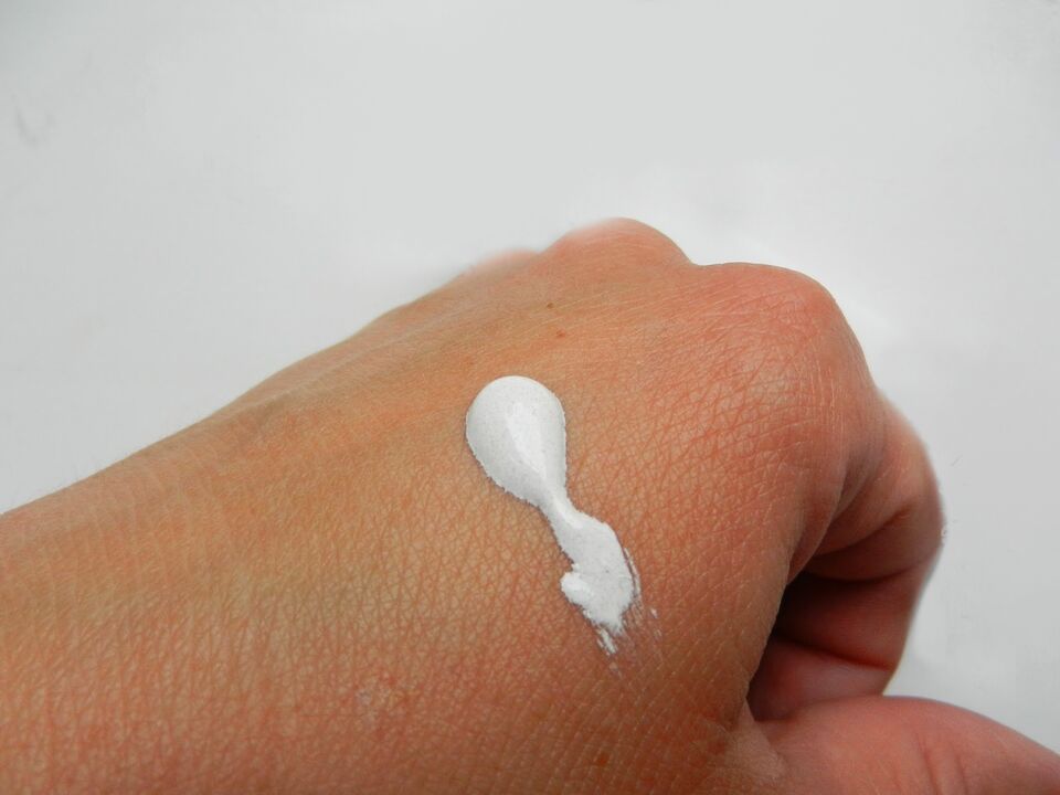 Photo of intenskin cream on hand from review by Elizabeth from Dublin