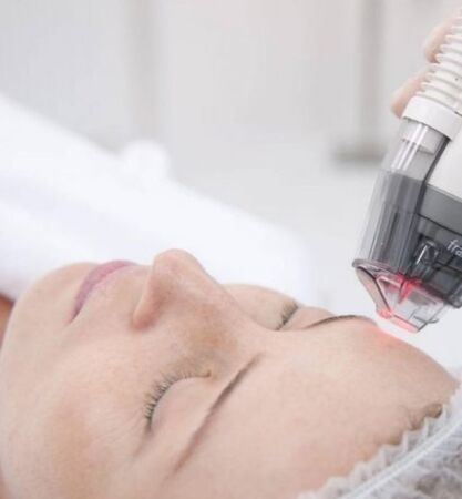 Photothermolysis