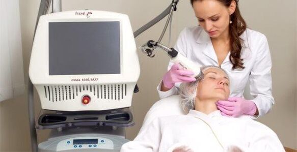 Fractional laser skin rejuvenation