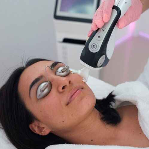 Facial skin treatment with fractional laser