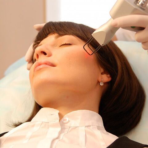 Fractional laser facial skin rejuvenation