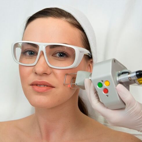 Fractional laser rejuvenation procedure that eliminates fine wrinkles