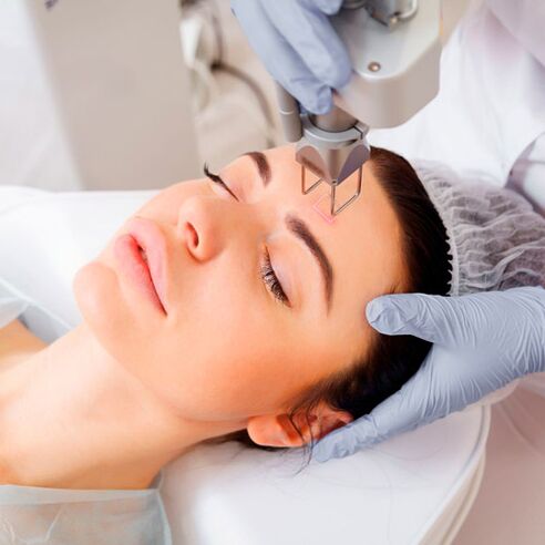 Photothermolysis procedure for facial skin rejuvenation