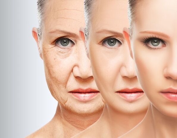 The process of getting rid of facial wrinkles thanks to plasma rejuvenation