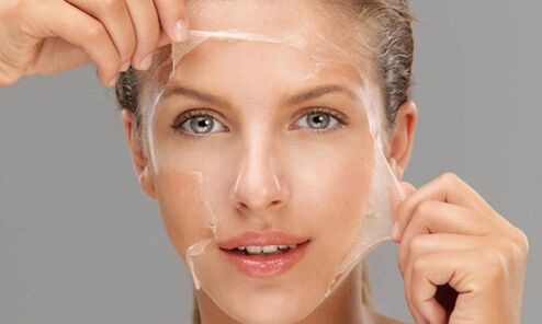Deep peeling enhances regeneration processes in the skin, rejuvenating it